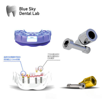 comprare Impianti dentali Scansione del corpo Impianti dentali Scansione dei corpi riutilizzabili online manufacture