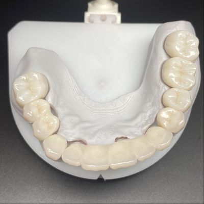 comprare Ponte in zirconia stratificata per restauro fisso bellissimo sorriso professionale stabile online manufacture