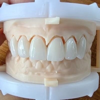 comprare Estetica naturale Ponte corona in zirconia stratificata per un bel sorriso e un buon restauro Certificazione FDA e CE online manufacture