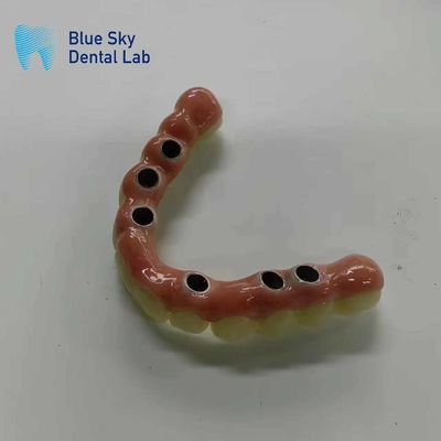 Sterilizzazione Sterilizzazione a vapore Casse per impianti con compatibilità universale