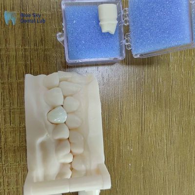 Circonia Restaurazioni dentali Circonia Corone di porcellana