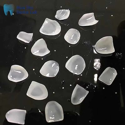 Finiture ultrafini E Max di classe ingot Ceramiche di aspetto naturale