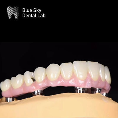Blue Sky Natura Impianto dentale Cassa Impianto Multiplici Scelte Sistema