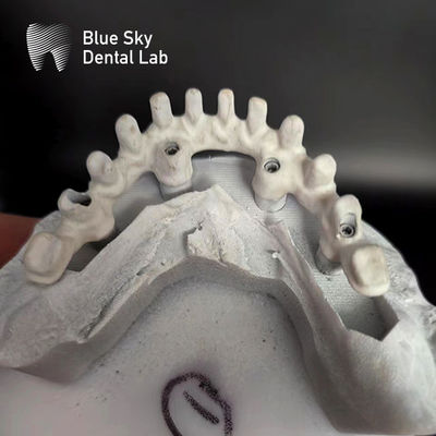 Implantazione di cielo blu personalizzabile