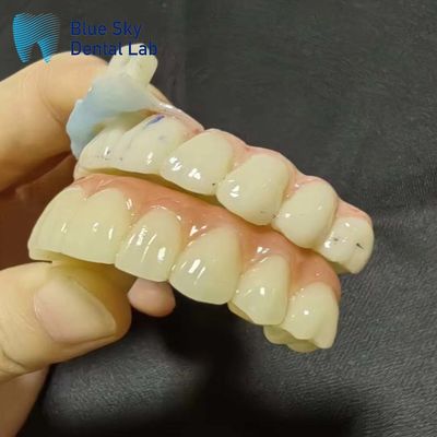 Casi di impianto Casi di impianto artificiale per la compatibilità del sistema senza soluzione di continuità