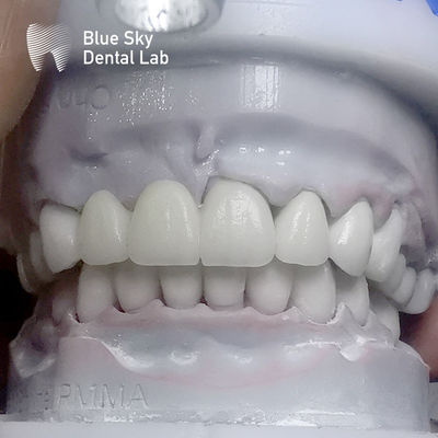 Denti di zirconia a strati rettangolari a più strati prima del vetro
