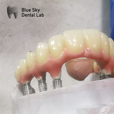 Forma naturale Casse per impianti dentali a arco completo Cassa per impianti dentali a superficie liscia