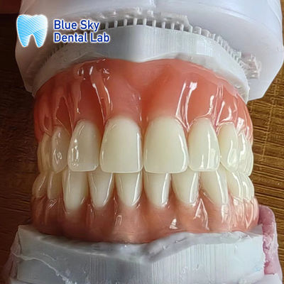 Dentiere naturale completo Acrilico Rimuovibile Dentieri completi Personalizzabili