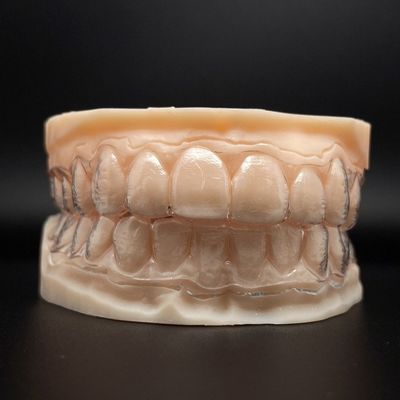 Denti personalizzabili, allineatori invisibili, parentesi chiare con tempi di trattamento più brevi